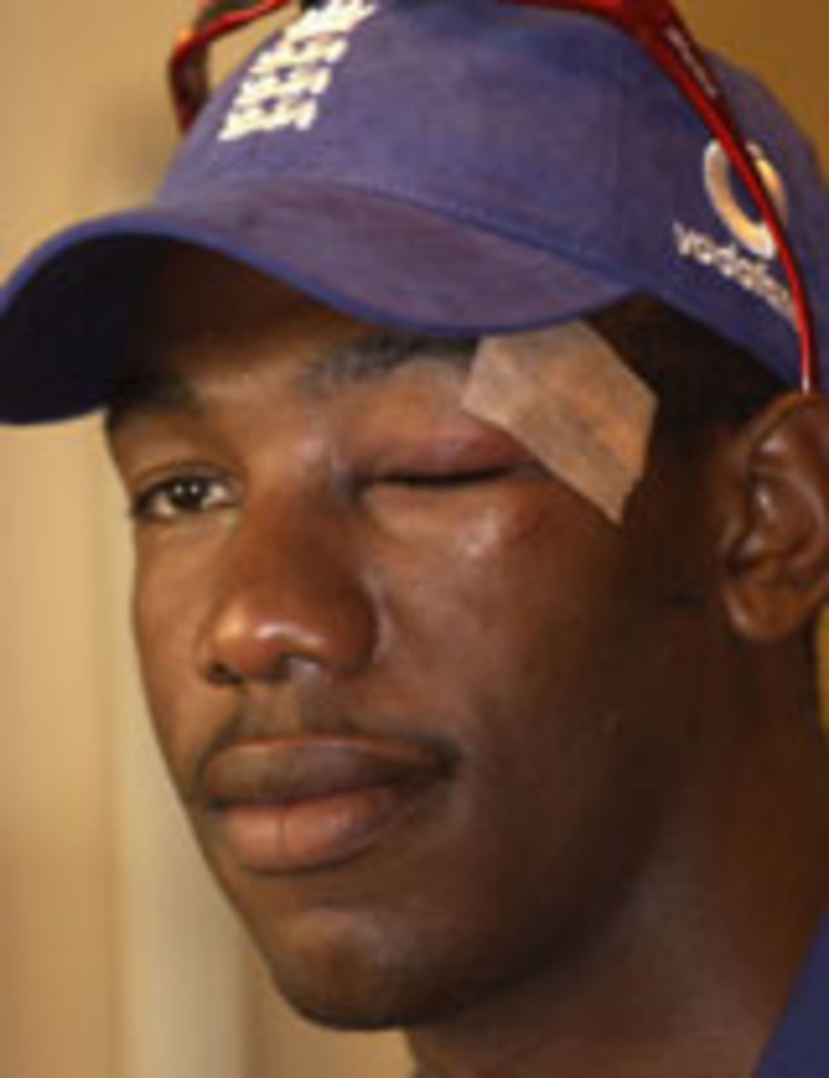 Alex Tudor nursing his eye injury