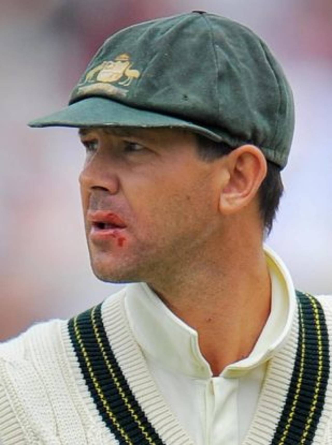 Ricky Ponting was in the wars as England piled on the runs&nbsp;&nbsp;&bull;&nbsp;&nbsp;Getty Images