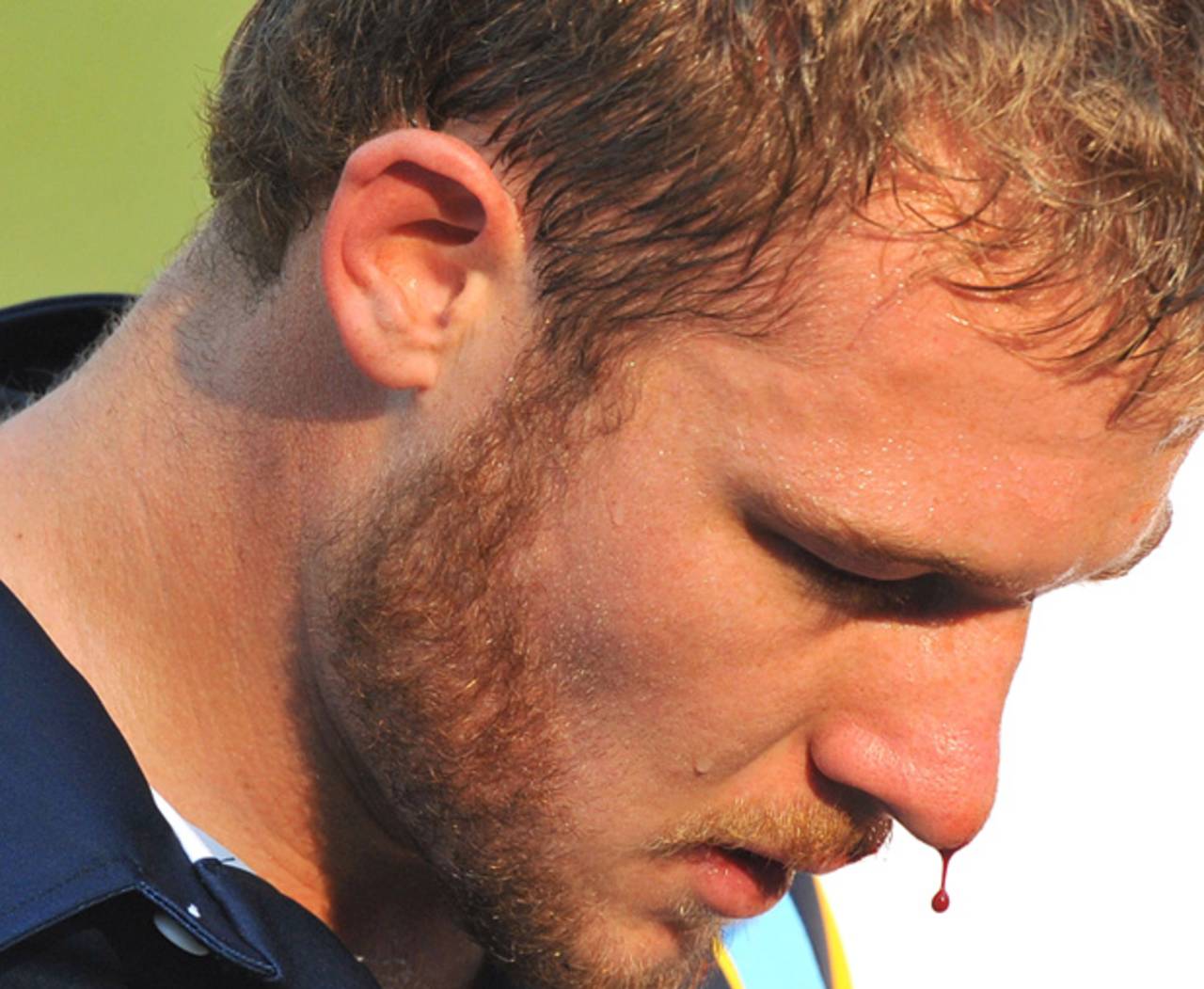 David Miller leaves the field with a bloody nose, Uva v Yorkshire, Champions League T20, Qualifying Tournament Pool 2, Johannesburg, October, 9, 2012