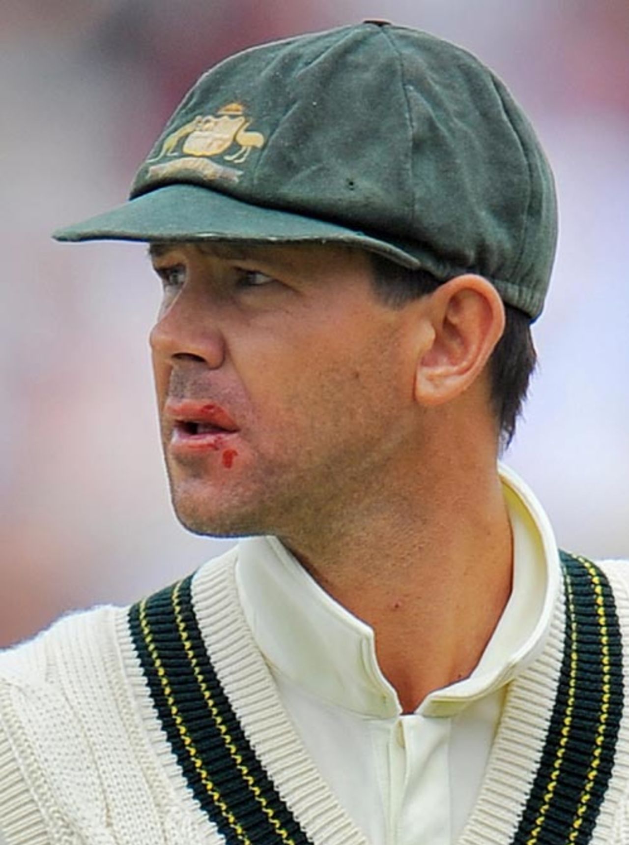 Ricky Ponting with a bloody lip, England v Australia, 5th Test, The Oval, 3rd day, August 22, 2009