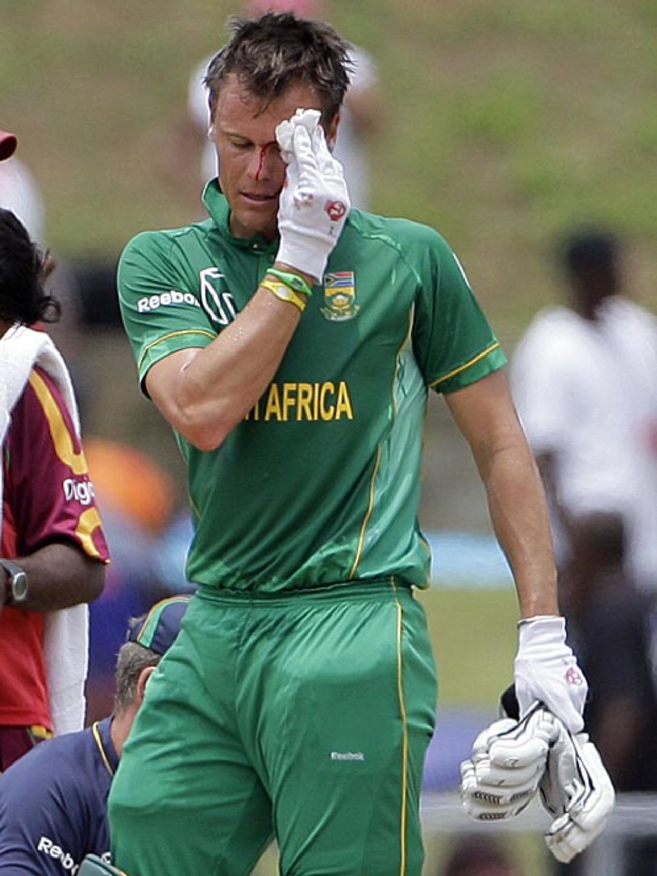Johan Botha bleeds after being struck above the eye, West Indies v South Africa, 3rd ODI, Dominica, May 28, 2010