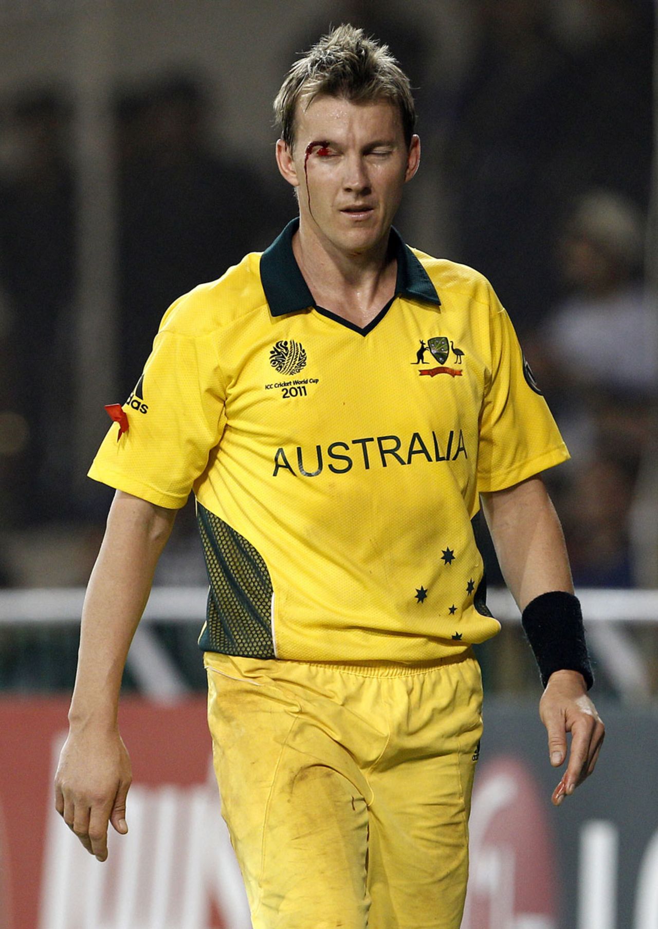 Brett Lee suffers a cut above his eye while fielding, India v Australia, 2nd quarter-final, Ahmedabad, World Cup 2011, March 24, 2011