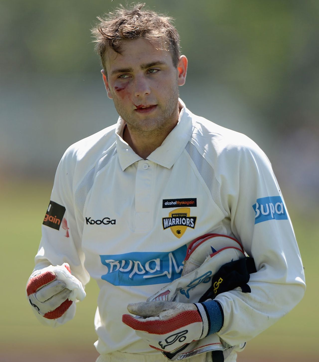 Tom Triffitt took a nasty blow in the face while keeping wicket, Western Australia Chairman's XI v England XI, 2nd day, Perth, November 1, 2103