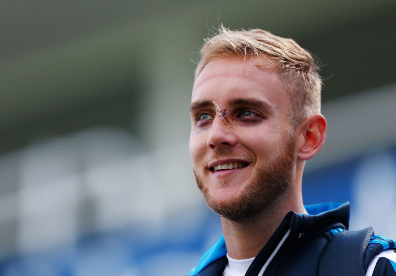Stuart Broad shows off his wounds, The Oval, August 14, 2014
