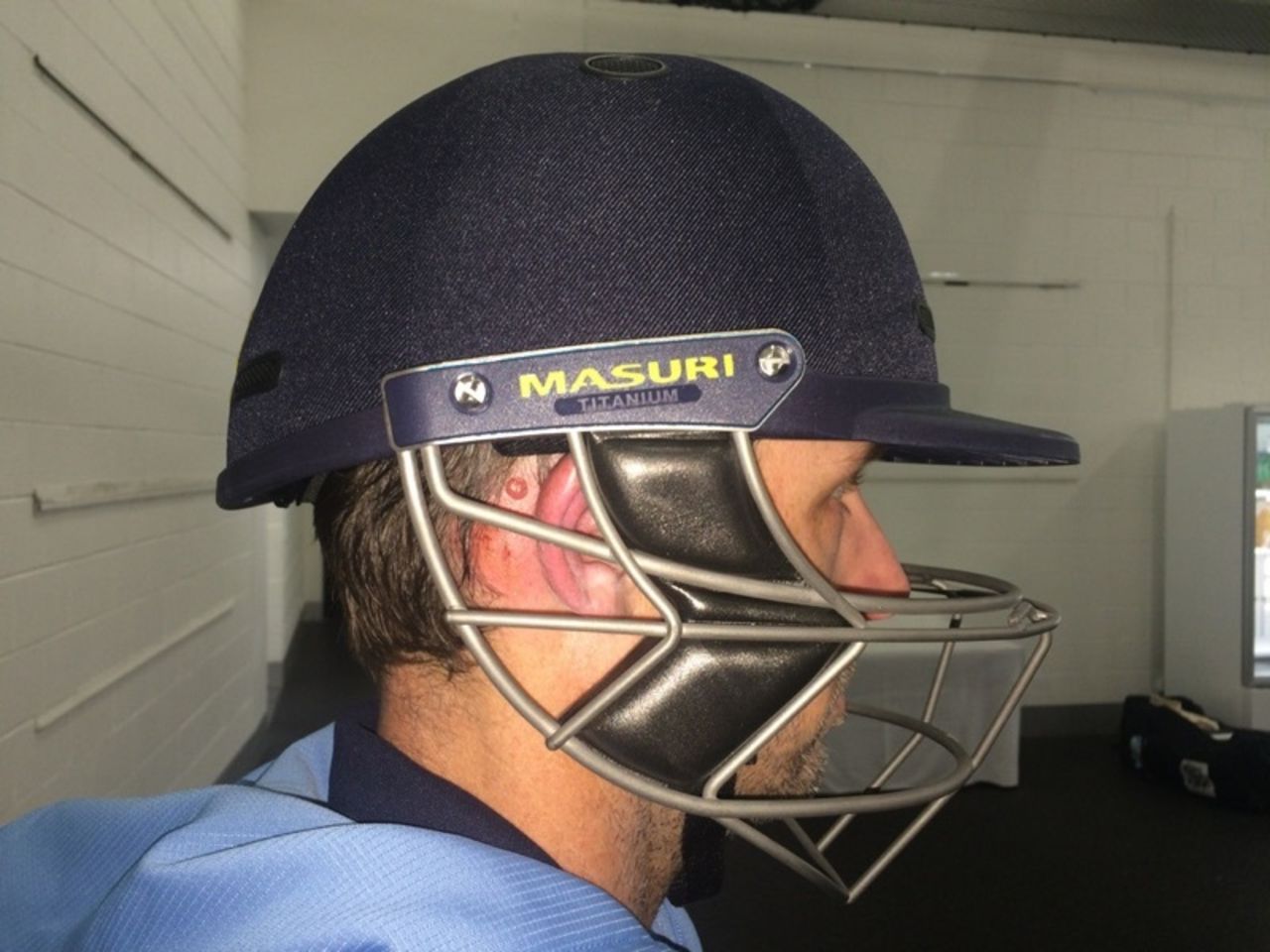 Ben Rohrer wearing the new Masuri helmet, showing where he was struck, Victoria v New South Wales, 4th day, Sheffield Shield, Melbourne, November 3, 2014