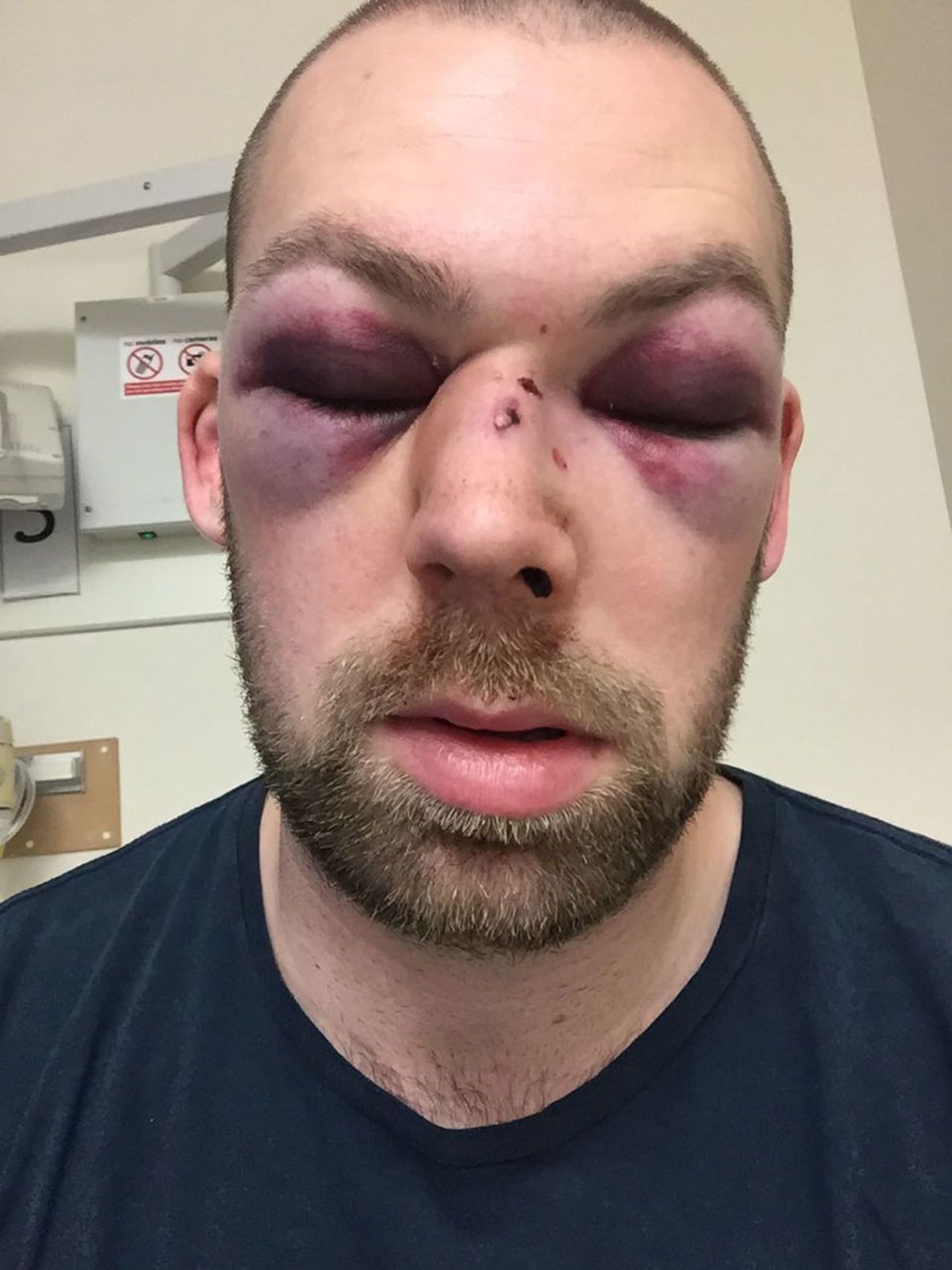 Alex Tait, club cricketer, after a horrific injury in the nets, February 23, 2017