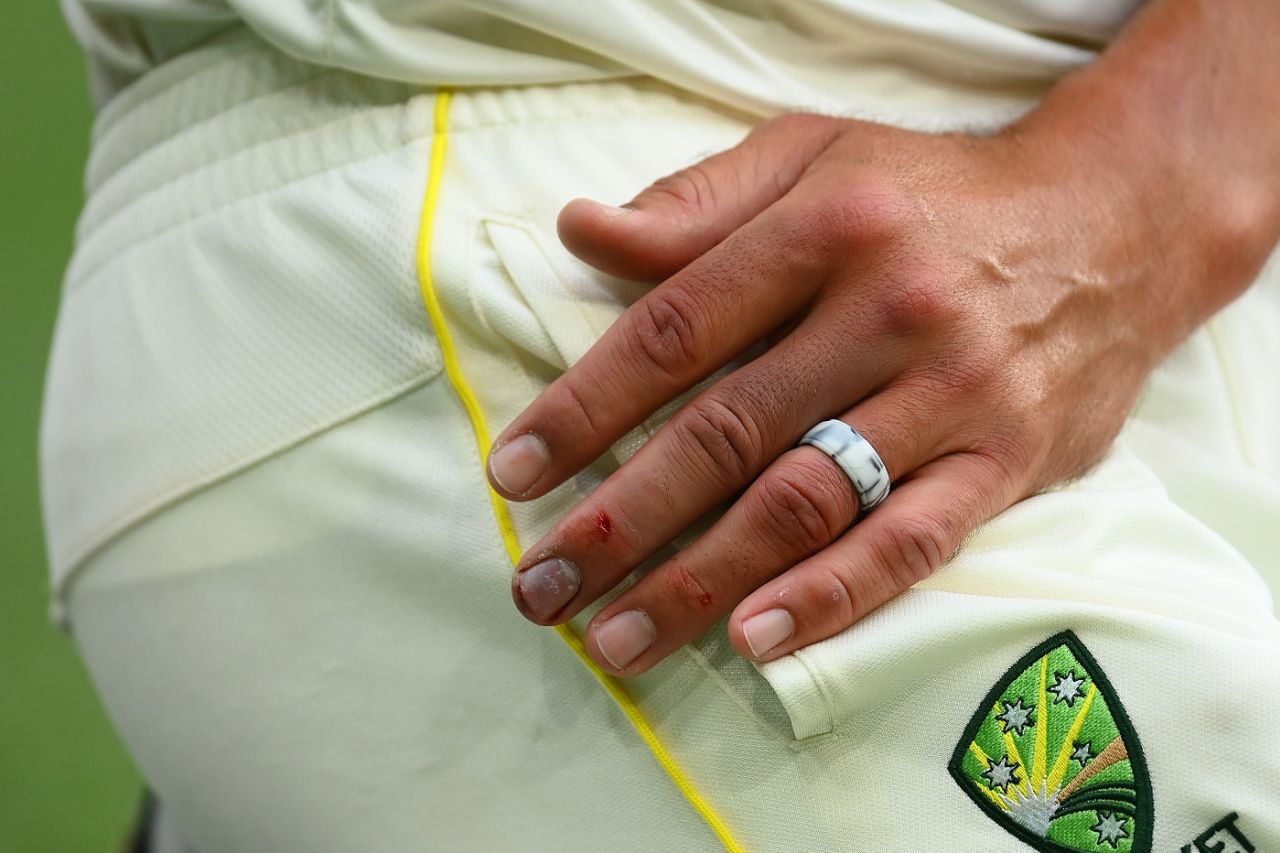 Mitchell Starc bowled through the pain, Australia vs South Africa, 2nd Test, Melbourne, 3rd day, December 28, 2022