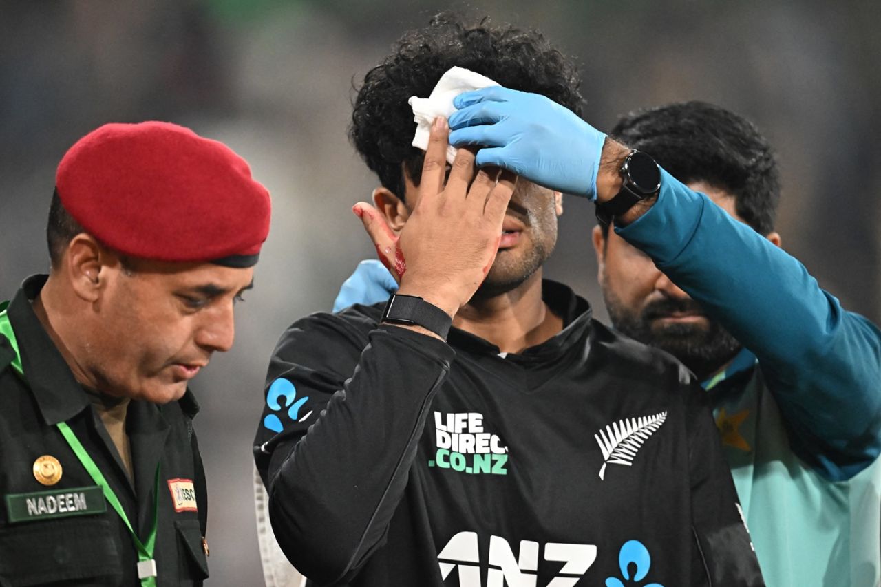 Rachin Ravindra will be doubtful for the Pakistan vs New Zealand match. | sportzpoint.com
