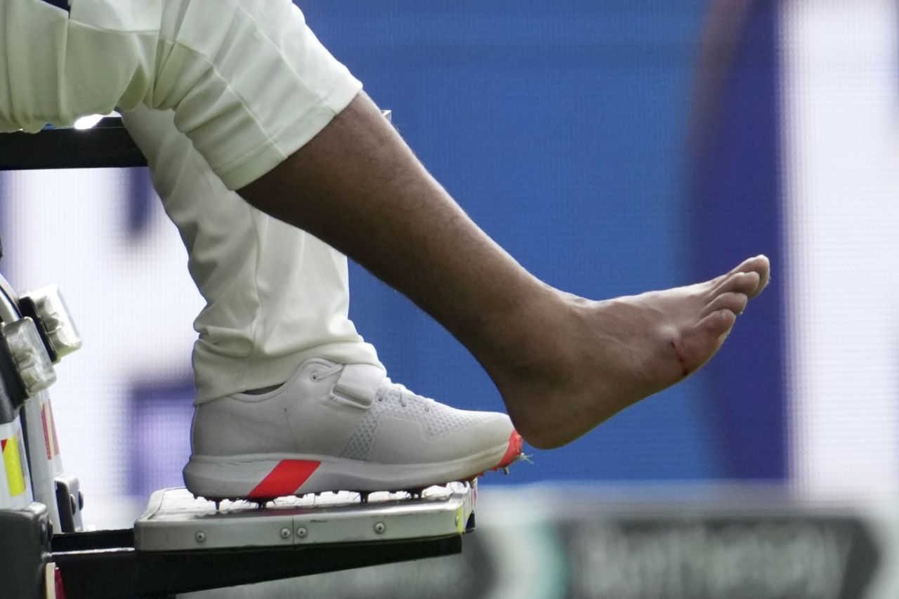Rishabh Pant's foot was swollen after being hit by the ball, England vs India, 4th Test, 1st day, Manchester, July 23, 2025