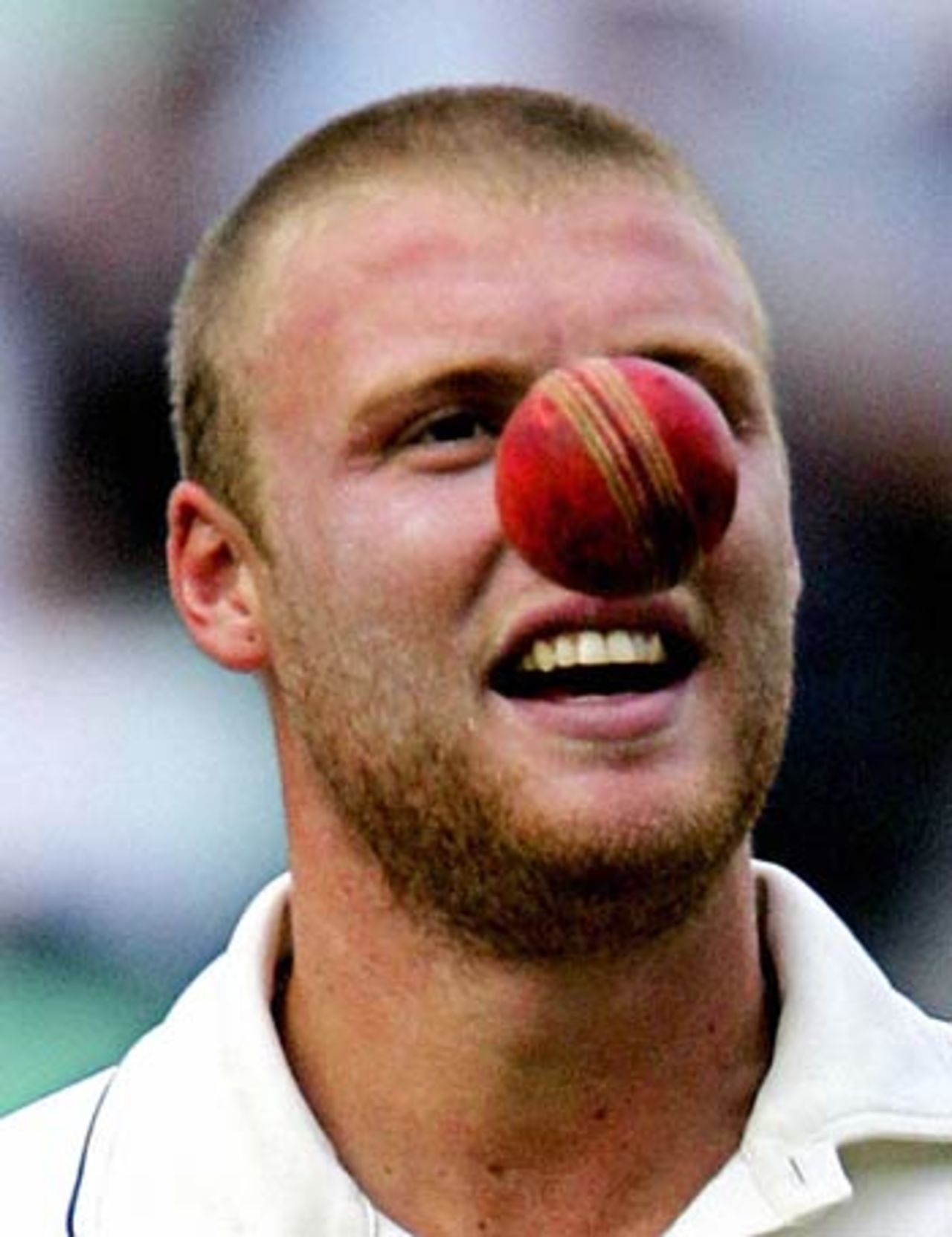 Andrew Flintoff's nose job, England v Australia, The Oval, London, September 9, 2005