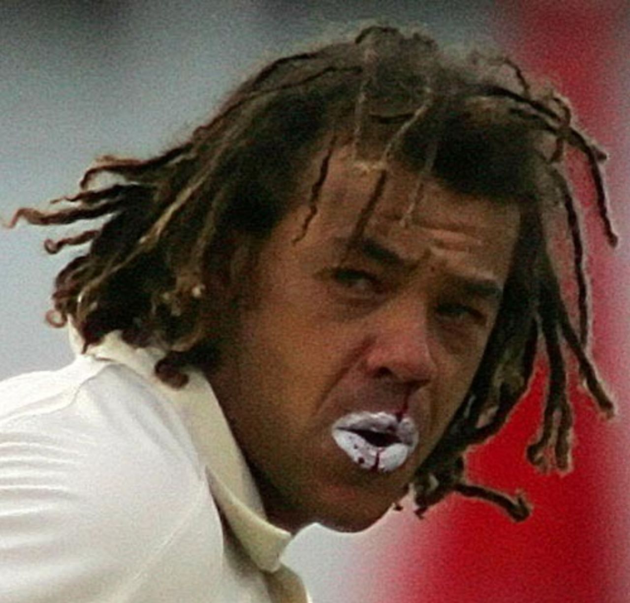 A bloodied Andrew Symonds after being hit, South Africa v Australia, 2nd Test, Durban, March 24, 2006