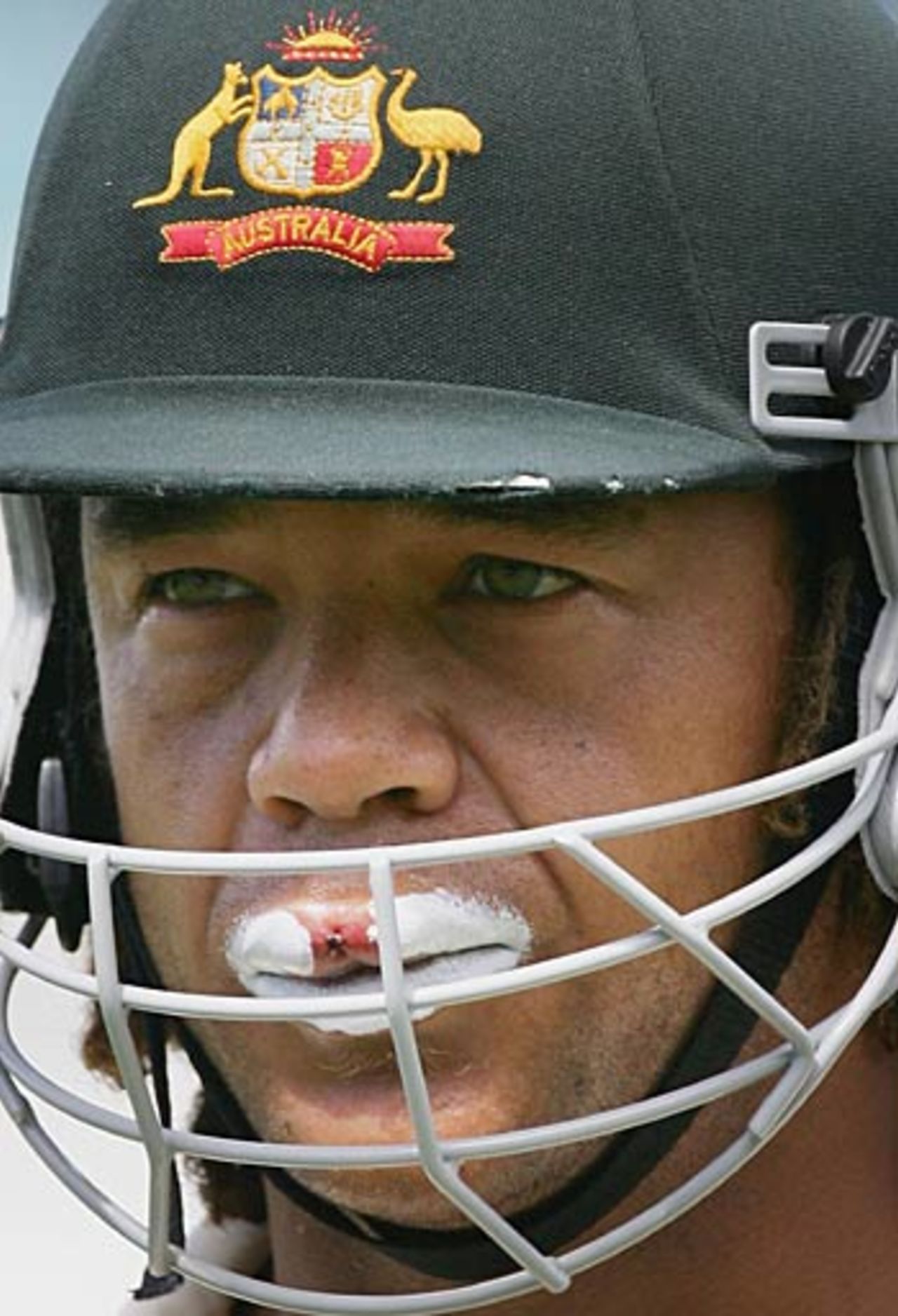 Andrew Symonds shows off his fat lip, sustained when he was hit by Makhaya Ntini late on the first day, South Africa v Australia, 2nd Test, Durban, March 25, 2006