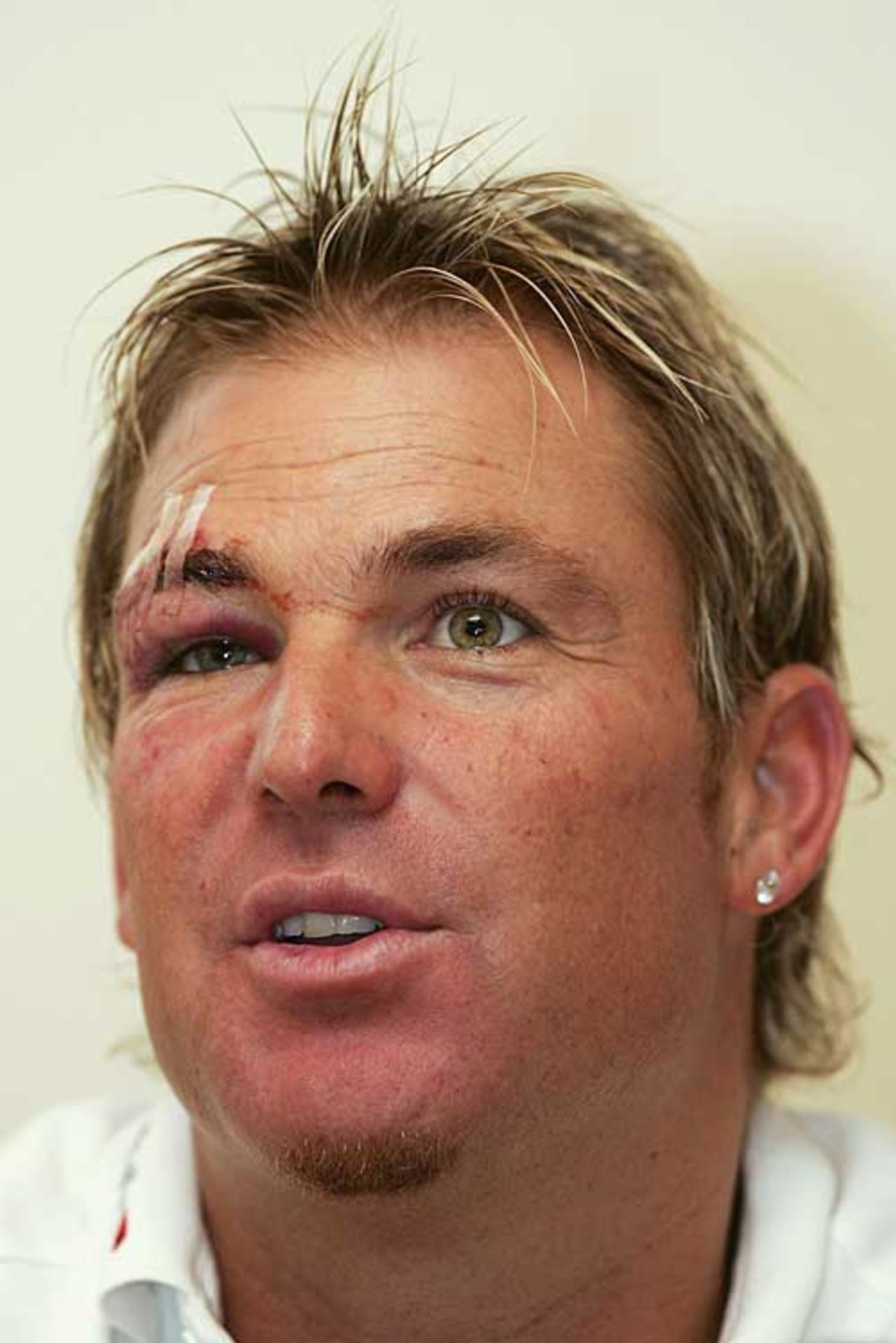Shane Warne sports his eye injury from the Pro40 at the launch of his latest book 'My Illustrated Career' in central London, Canary Wharf, September 14, 2006