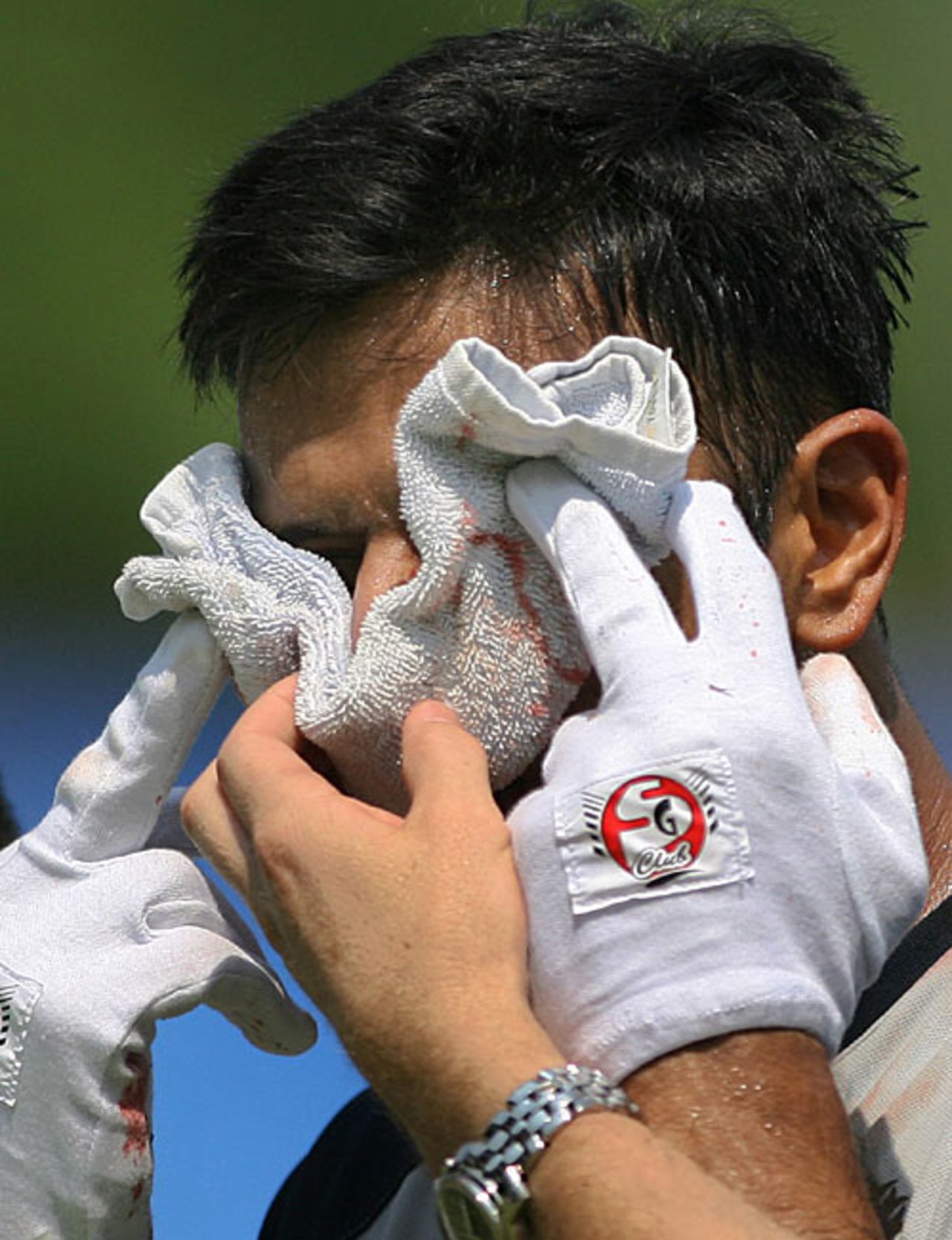 Rahul Dravid's face is covered by a bloody towel after after being hit on the nose in a net session, Eden Gardens, Kolkata, May 5, 2007