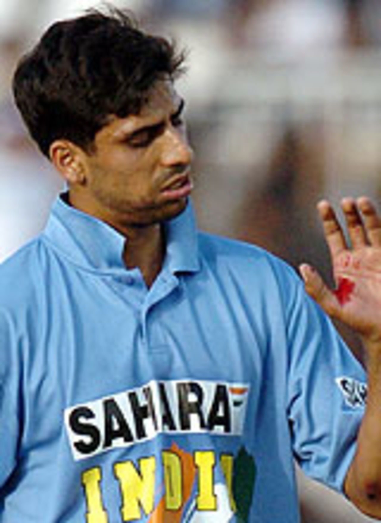 Ashish Nehra has hurt his hand, Pakistan v India, 2nd ODI, Rawalpindi, March 16, 2004
