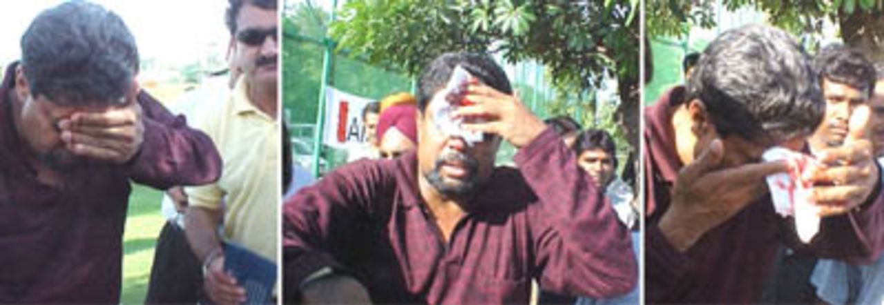 Kapil Dev coming out of the golf course after being accidentally hit on the forehead by a golf  ball