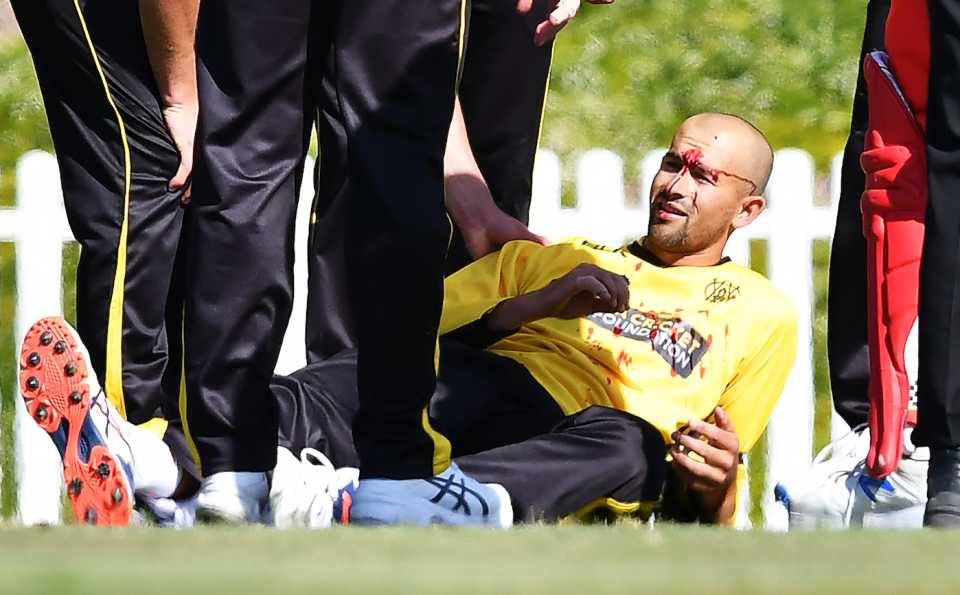 Ashton Agar left bloodied after copping a ball in the head that was hit by his brother Wes Agar