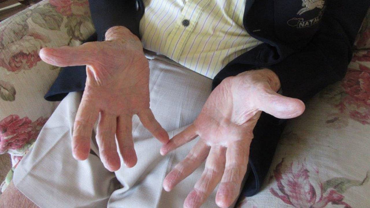 The hands of a slip catcher: former South African allrounder John Watkins