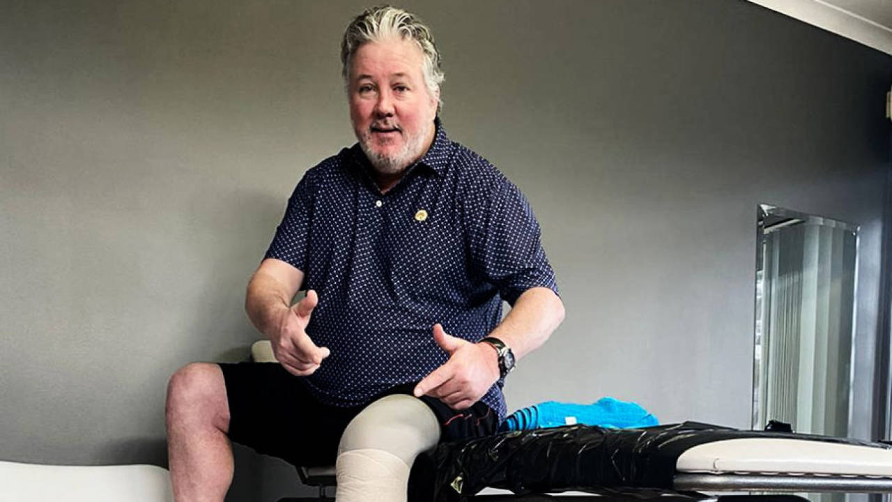 Andy Moles with his prosthetic leg