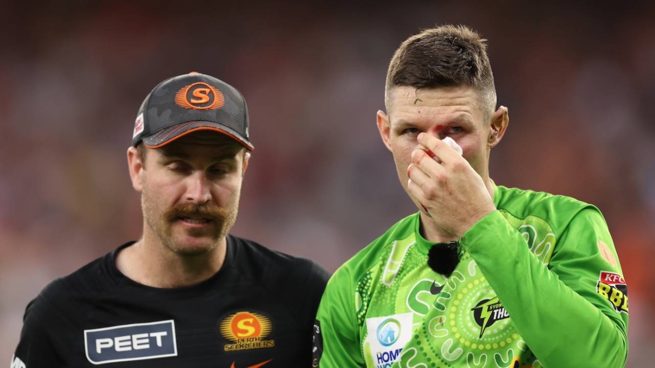 Cameron Bancroft left the field with a bloodied nose after the collision, Perth Scorchers vs Sydney Thunder, BBL, Perth, January 3, 2025